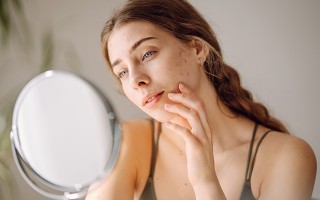 Unreine Haut im Herbst: Ursachen und Tipps